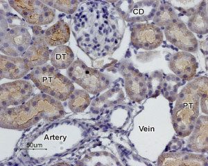 Expression of α2C-Adrenoreceptor in rat kidney