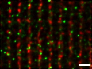 Anti-Cav1.2a (CACNA1C) Antibody Anti-Cav1.2a (CACNA1C) Antibody