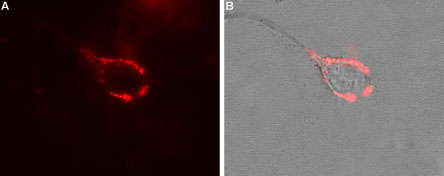 Expression of CaVα2δ1 in rat PC12 cells
