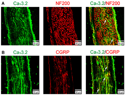 Anti-Cav3.2 (CACNA1H) Antibody Anti-Cav3.2 (CACNA1H) Antibody