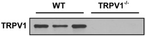 Anti-TRPV1 (VR1) Antibody Anti-TRPV1 (VR1) Antibody