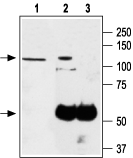 Immunoprecipitation of PC-12 lysates: