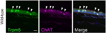 Anti-TRPM5 Antibody Anti-TRPM5 Antibody