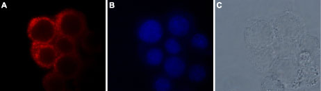 Expression of TRPM7 in GH3 cell lines