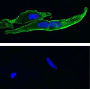 Anti-TRPM8 (extracellular) Antibody Anti-TRPM8 (extracellular) Antibody