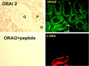 Anti-Orai2 Antibody Anti-Orai2 Antibody