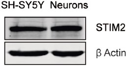 Anti-STIM2 Antibody Anti-STIM2 Antibody