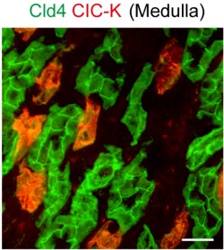 Anti-CLC-K Antibody Anti-CLC-K Antibody
