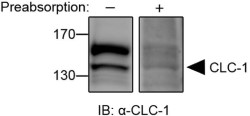 Anti-CLC-1 (CLCN1) Antibody Anti-CLC-1 (CLCN1) Antibody