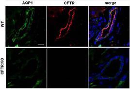Anti-CFTR Antibody