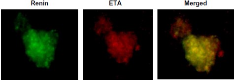 Anti-Endothelin Receptor A Antibody Anti-Endothelin Receptor A Antibody