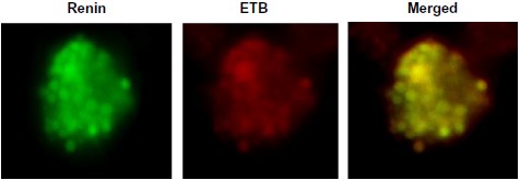 Anti-Endothelin Receptor B Antibody Anti-Endothelin Receptor B Antibody