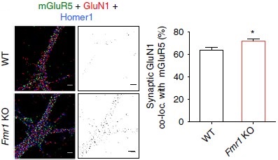 Anti-NMDAR1 (GluN1) (extracellular) Antibody