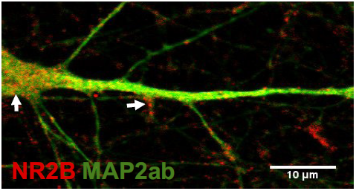 Anti-NMDAR2B (GluN2B) (extracellular) Antibody