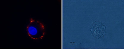Expression of mGluR1 in rat C6 glioma cells