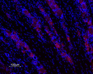 Expression of Galanin receptor 1 in rat DRG