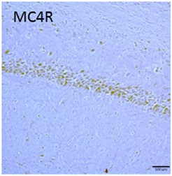 Anti-MC4 Receptor (extracellular) Antibody Anti-MC4 Receptor (extracellular) Antibody