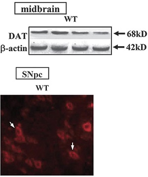 Anti-Dopamine Transporter (DAT) (extracellular) Antibody Anti-Dopamine Transporter (DAT) (extracellular) Antibody