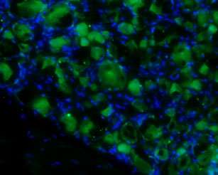 Expression of proBDNF in rat DRG