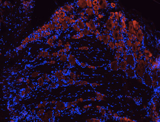 Expression of TrkB in rat DRG