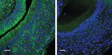 Anti-GIRK1 (Kir3.1) Antibody
