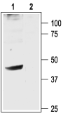 Western blot analysis of rat brain membranes: