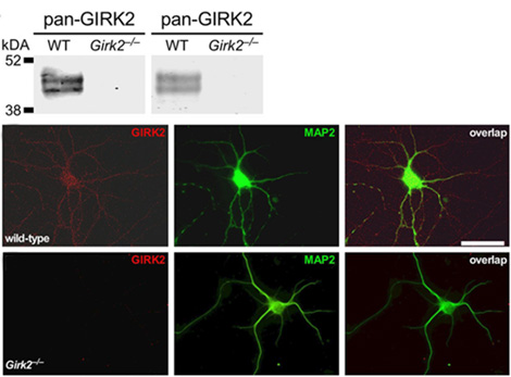 Anti-GIRK2 (Kir3.2) Antibody Anti-GIRK2 (Kir3.2) Antibody