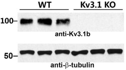 Anti-Kv3.1b (KCNC1) Antibody Anti-Kv3.1b (KCNC1) Antibody