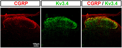Anti-KCNC4 (Kv3.4) Antibody Anti-KCNC4 (Kv3.4) Antibody