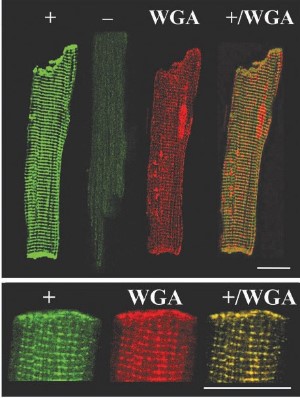 Anti-KCNK3 (TASK-1) Antibody Anti-KCNK3 (TASK-1) Antibody