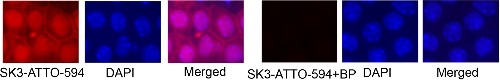 Anti-KCNN3 (KCa2.3, SK3) (N-term)-ATTO Fluor-594 Antibody Anti-KCNN3 (KCa2.3, SK3) (N-term)-ATTO Fluor-594 Antibody
