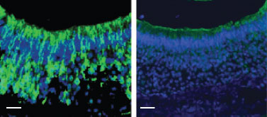 Anti-KCNN3 (KCa2.3, SK3) (N-term) Antibody