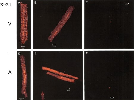 Anti-Kir2.1 (KCNJ2) Antibody Anti-Kir2.1 (KCNJ2) Antibody