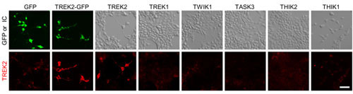 Anti-KCNK10 (TREK-2) Antibody