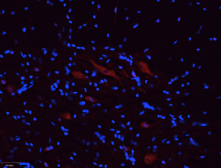 Expression of P2RX5 in rat spinal cord