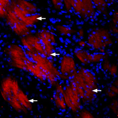 Expression of P2RY12 in rat striatum
