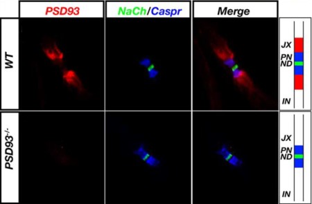 Anti-PSD-93 Antibody Anti-PSD-93 Antibody