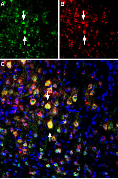 Anti-NMDAR2B (GluN2B) (extracellular)-ATTO Fluor-594 Antibody