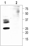 Western blot analysis of rat kidney membranes: