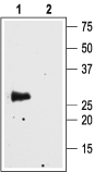 Western blot analysis of rat brain membranes: