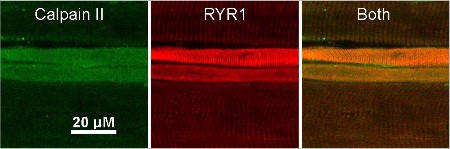 Anti-Ryanodine Receptor 1 Antibody Anti-Ryanodine Receptor 1 Antibody