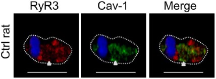 Anti-Ryanodine Receptor 3 Antibody Anti-Ryanodine Receptor 3 Antibody