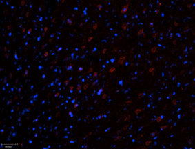 Expression of RyR3 in rat cortex