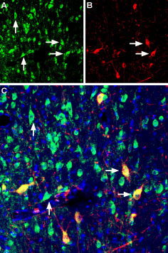 Mouse Anti-Rat p75 NGF Receptor (extracellular) Antibody