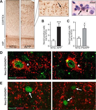 Anti-SCN2B (Navβ2) Antibody Anti-SCN2B (Navβ2) Antibody