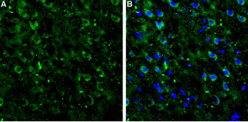 Expression of mGluR7 in rat neocortex