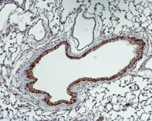 Expression of GABA transporter 2 in rat lung