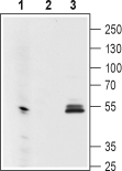 Western blot analysis using Mouse Anti-GIRK1 (Kir3.1) (extracellular) Antibody (#ALM-031), (1:200):