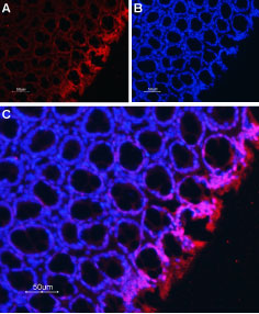 Expression of Na+/H+ exchanger 2 in rat colon