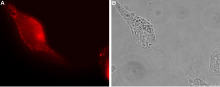 Expression of GluR1 in human U-87 MG cells